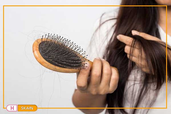 سبب تساقط الشعر بكثرة و افضل علاج لتساقط الشعر
