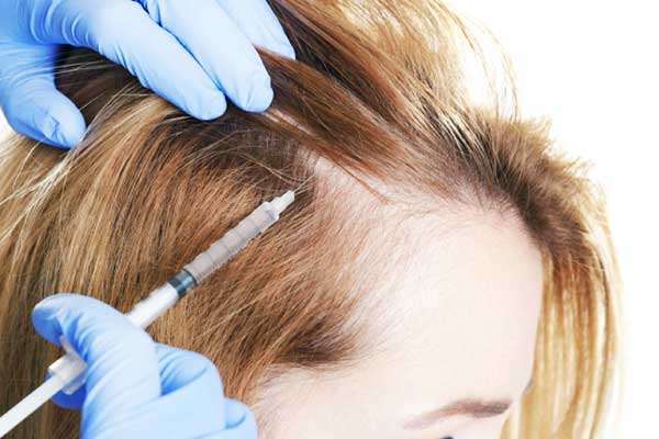 Follicular Unit Extraction (FUE)